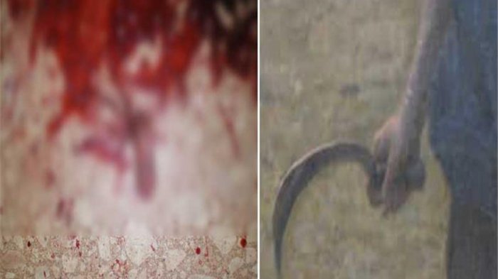 Satu Orang Tewas di TKP, Satu Lagi Tewas dalam Perjalanan, Polisi Langsung Lakukan Penjagaan