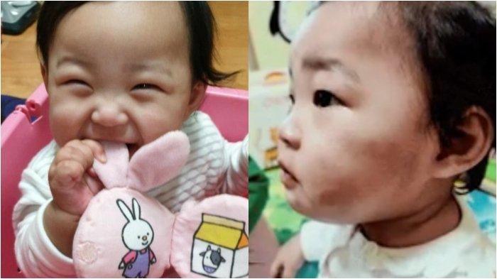 Sebelum Meninggal, Bayi Ini Ingin Terus Dipeluk Gurunya, Terungkap Penyiksaan Orang Tua Angkat