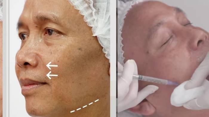 Pantesan Ayah Rozak Terlihat Glowing Seperti ABG, Diam-diam 'Permak' Wajah Belasan Juta Pakai Ini