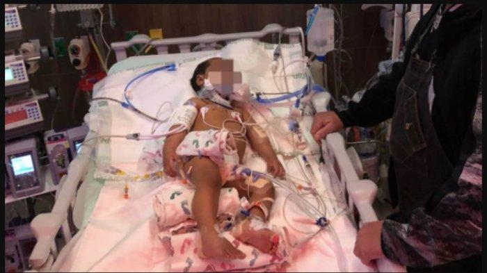 Seorang Balita Jadi Santapan 5 Ekor Anjing Pitbull, Kondisinya Sangat Parah dan Mengenaskan