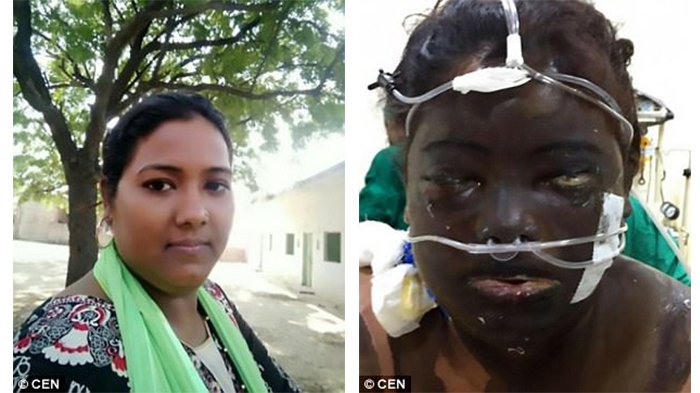 Istri Dapat Kerja, Suami Ini Mengamuk Siram Wajah Cantik Sang Istri hingga Satu Mata Buta