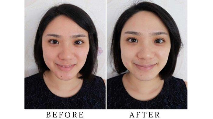 Wajah Cerah dan Mulus Seketika dengan Perawatan Instant Glowing