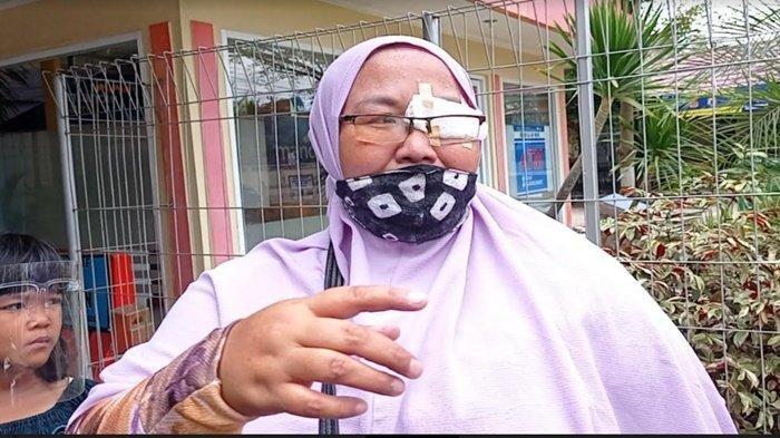 Uang Bantuan untuk Operasi Mata Dicopet, Wanita Ini Sesegukan Melapor Ke Polisi