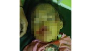 Breaking_News_Bocah_Perempuan_di_Pekanbaru_Terluka_Diduga_Diserang_Gajah.jpg