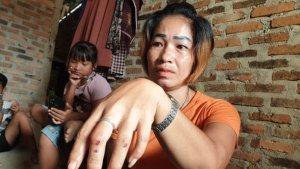 Cerita-Sri-yang-trauma-serangan-TNI.jpg