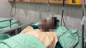 Pelajar_di_Pekanbaru_Diduga_Jadi_Korban_Perundungan_Hingga_Patah_Tulang__Orang_Tua_Lapor_Polisi.jpg