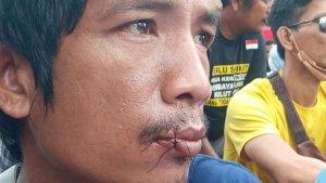 aksi-Gerlamata-riau.jpgaksi-jahit-mulut-jl-cut-nyak-dien.jpgaksi-gerlamata-riau1.jpgaksi-gerlamata-riau2.jpg