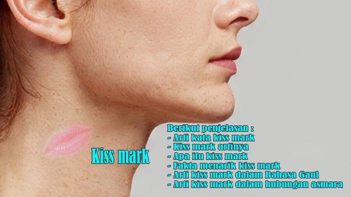 Arti Kata Kiss Mark, Kiss Mark Artinya, Apa Itu Kiss Mark, Fakta Menarik, Bahasa Gaul dan Hubungan