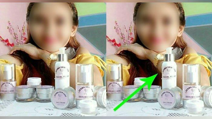 Transfer Rp 1,5 Juta Beli Skin Care, Barang Tak Dikirim No HP Diblok Penipu, Mahasiswi Lapor Polisi