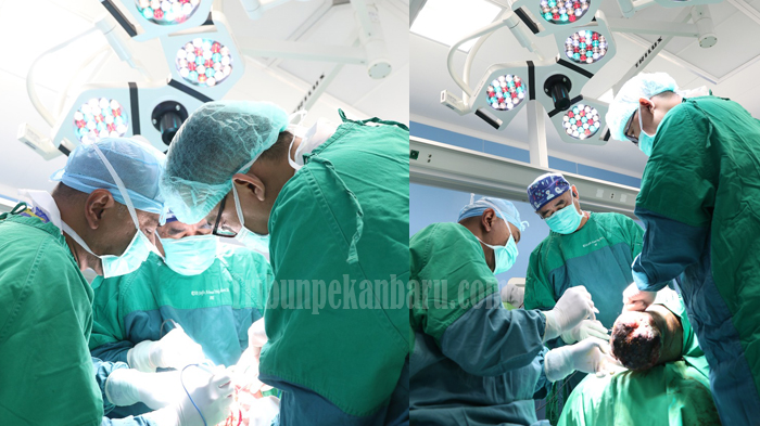 eksklusif-operasi-tumor-sebesar-bola-dan-mengganti-tengkorak-kepala-di-rsud-arifin-achmad-riau.jpg