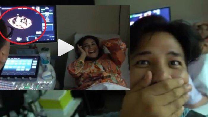 Irish Bella Hamil Bayi Kembar, Lihat Ekspresi Ammar Zoni Terperanjat Haru Menatap Layar USG