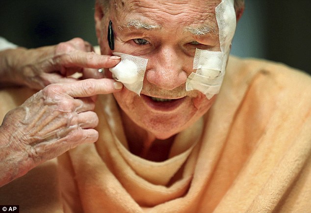 Pria Tua ini Gunakan Lintah Untuk Obati Matanya yang Buta, Simak Penjelasannya