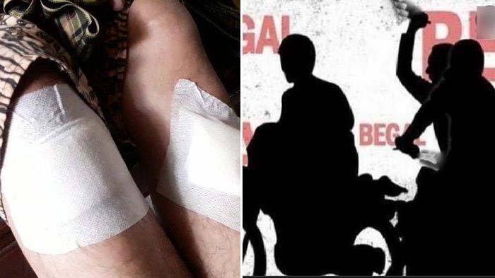 Diamuk Begal Sampai Luka-luka, Warga Ramai Tak Ada yang Membantu, Hanya Menjadikan Itu Tontonan Pagi