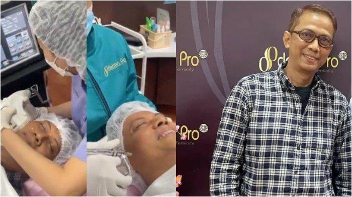 Tak Mau Kalah Sama Dua Anaknya, Doddy Sudrajat Pamer Hasil Permak Wajah, Dokter Pun Kena Hujatan