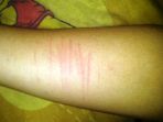 55-siswa-smp-di-pekanbaru-sayat-tangan-ternyata-perempuan-ini-alasannya_20181001_172456.jpg