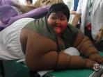 arya-permana-penderita-severe-obesity-obesitas_20160714_204103.jpg