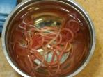 ascaris-lumbricoides-cacing-gelang_20180505_150429.jpg