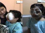 gadis-kecil-ini-harus-menjalani-operasi-mata.jpg