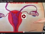 gambar-vagina_20150920_212231.jpg