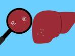 ilustrasi-organ-hati-kemenkes-minta-warga-waspadai-penyakit-hepatitis.jpg