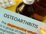 ilustrasi-osteoartritis-1_20150831_153253.jpg