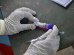 ilustrasi-sample-swab-tes.jpg