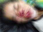 jasmani-korban-digigit-orangutan.jpg