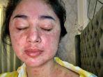 kabar-buruk-dari-dp-wajah-tubuhnya-memerah-ternyata-dewi-perssik-positif-covid-19-virus-corona.jpg