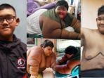 kabar-mengejutkan-arya-permana-yang-dulu-sangat-gemuk-kini-alahami-berubah-drastis-tak-disangka.jpg