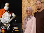 masih-terbaring-lemah-dipasangkan-selah-di-rumah-sakit-kondisi-terkini-gary-iskak-istri-semangati.jpg
