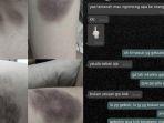 memar-di-tubuh-sang-gadis-dan-bukti-chat-dengan-sang-mantan-saat-pacaran.jpg