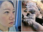 pilu-foto-perjuangan-tim-medis-rawat-pasien-virus-corona-tidur-di-lantai-luka-luka-wajah-memar.jpg