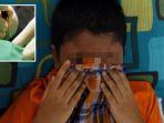 proses-sunatnya-berlangsung-selama-4-jam-lihatlah-kelamin-bocah-3-tahun-ini-ayahnya-hampir-pingsan.jpg