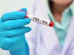 sampel-tes-dna.jpg