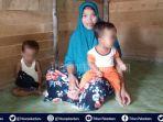 story-kisah-keluarga-kurang-mampu-di-riau-yang-anaknya-alami-gizi-buruk-sang-ibu-hanya-pasrah.jpg