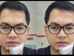 tommy-kurniawan-dapat-14-jahitan-di-dagu-ada-apa.jpg
