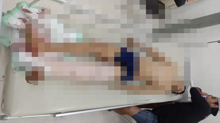 Terduga Pelaku Pembunuhan Mirawati Dinyatakan Meninggal Dunia