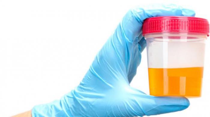 Tes Urine Peserta SNMPTN dan SBMPTN Untan Tak Disambut Baik Calon Mahasiswa
