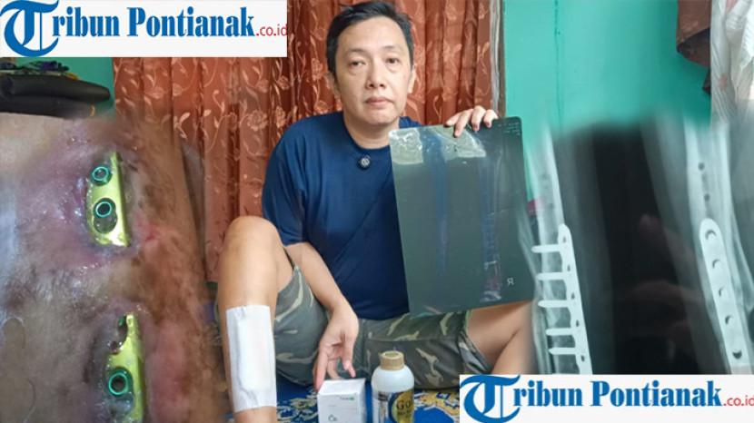 Tribun