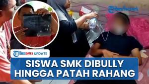 Bullying-SMK-Cikarang-Sebabkan-Rahang-Patah-dan-Trauma-Psikis.jpg