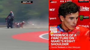 RESMI-Marc-Marquez-Absen-di-MotoGP-2025-Kembali-ke-Meja-Operasi-usai-Crash-Brutal-di-Mandalika.jpg