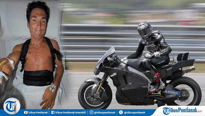 Kondisi Terkini Aleix Espargaro: Alami Patah 4 Tulang Belakang Usai Insiden Tes MotoGP