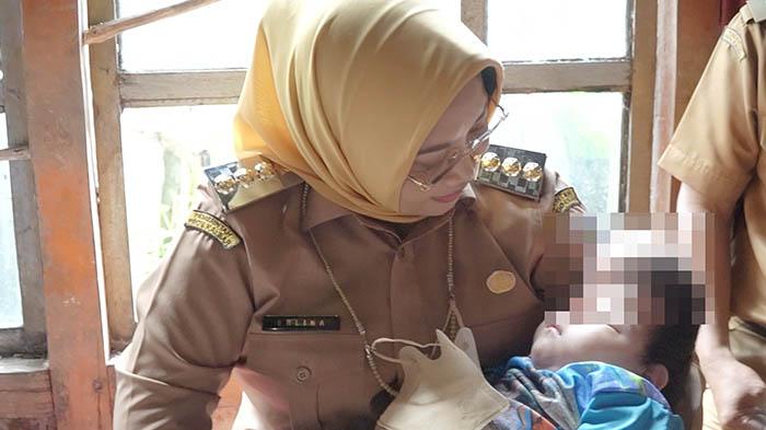 Bupati Mempawah Jenguk Al Qori Ramadhan Bayi yang Lahir Tanpa Tempurung Kepala di Sungai Pinyuh