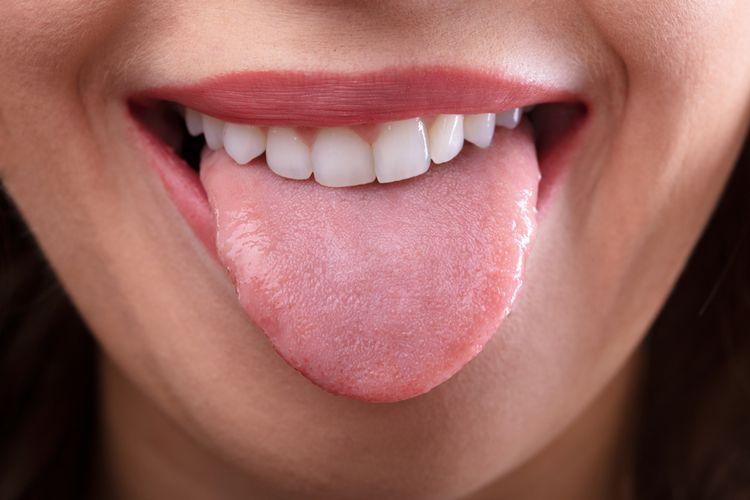 Cara-Mengatasi-Sariawan-di-Lidah-yang-Buat-Makan-Tak-Nyaman.jpg