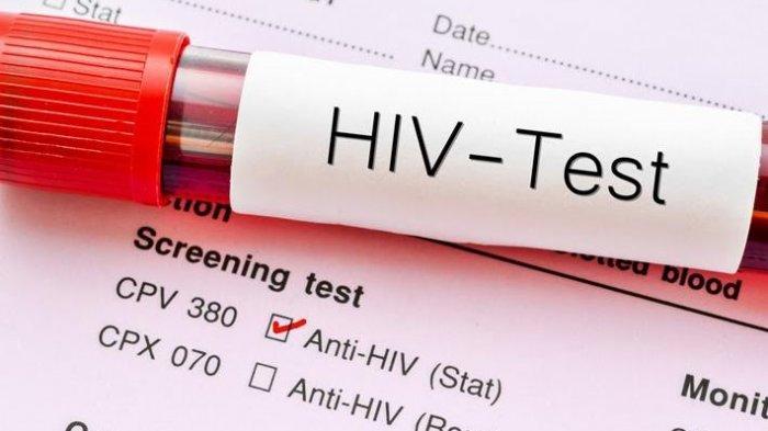 Gejala-Terbaru-HIV-AIDS-yang-Perlu-Diwaspadai-dan-Cara-Penularannya.jpg