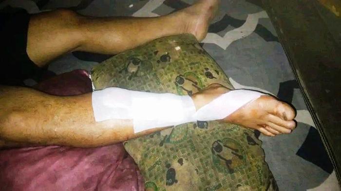 Warga Perapakan Sambas Diterkam Buaya Saat Menjala Ikan