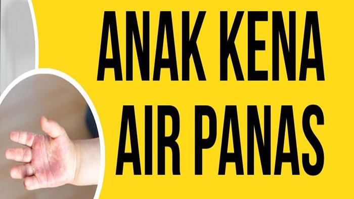 TEGA-Nasib-Ibu-Siram-Anak-Pakai-Air-Panas-Mendidih-di-Ambon.jpg