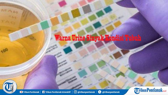 Warna-Urine-fghjmnm.jpg