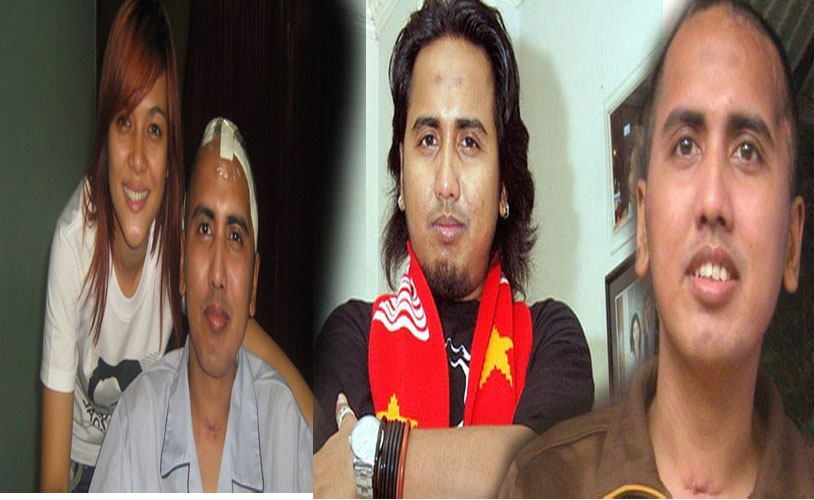 Akibat Mengidap Penyakit Dimensia, Gugun Gondrong Hanya Bisa Mendengar Tak Bisa Lihat Dari Jauh