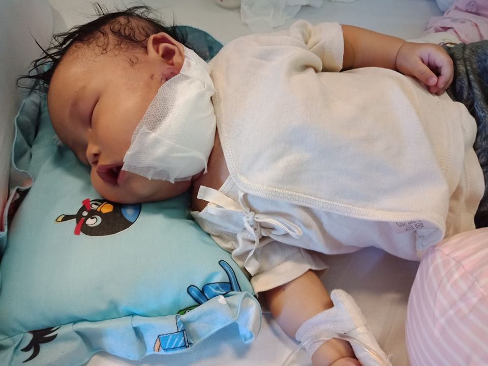 Love And Caring Community Galang Dana untuk Bayi Penderita Tumor